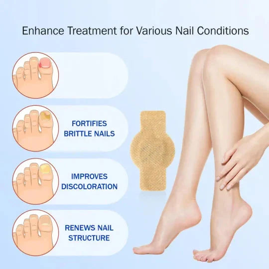 NailHeal™ - Fungal Nail Patches 🌿💅 ( Buy 1 Get 1 Free🔥🔥)